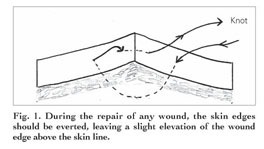 eversion suture